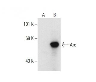 Arc Antibody C 7 SCBT Santa Cruz Biotechnology