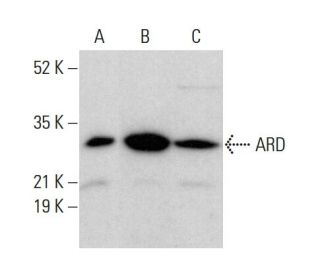 ARD Antibody (H-3) - Western Blotting - Image 375577 