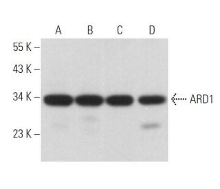 ARD1 Antibody (A-10) - Western Blotting - Image 372582