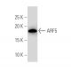 ARF5 Antibody (14-07) - Western Blotting - Image 33543 