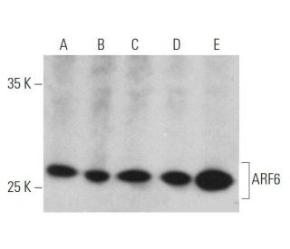 ARF6 Antibody (3A-1) - Western Blotting - Image 355307Each CRISPR/Cas9 Knockout (KO) Plasmid product consists of a pool of 3 plasmids designed to ensure identification and cleavage of a specific gene for maximum knockout efficiency. Each plasmid encodes a unique 20 nt sequence derived from the GeCKO (v2) library.