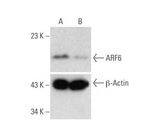 ARF6 Double Nickase Plasmid (h): sc-400799-NIC-2. Western blot analysis of ARF6 expression in non-transfected control (A) 
