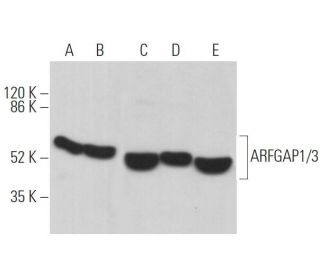 ARFGAP1/3 Antibody (D-8) - Western Blotting - Image 361984 