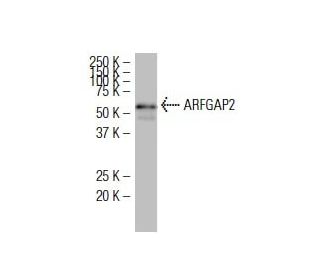 ARFGAP2 Antibody (RG-7) - Western Blotting - Image 34344 