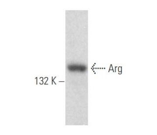 western blotting image from recommended Arg (1H1B11) monoclonal antibody replacement. Image 356094
