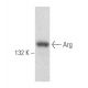 western blotting image from recommended Arg (1H1B11) monoclonal antibody replacement. Image 356094