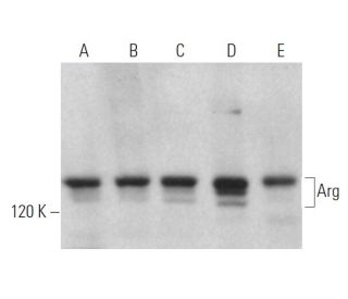Arg Antibody (1H1B11) - Western Blotting - Image 363168Each CRISPR/Cas9 Knockout (KO) Plasmid product consists of a pool of 3 plasmids designed to ensure identification and cleavage of a specific gene for maximum knockout efficiency. Each plasmid encodes a unique 20 nt sequence derived from the GeCKO (v2) library. 