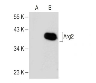 Arginase 2/ARG2 Antibody (C-3) - Western Blotting - Image 150435 