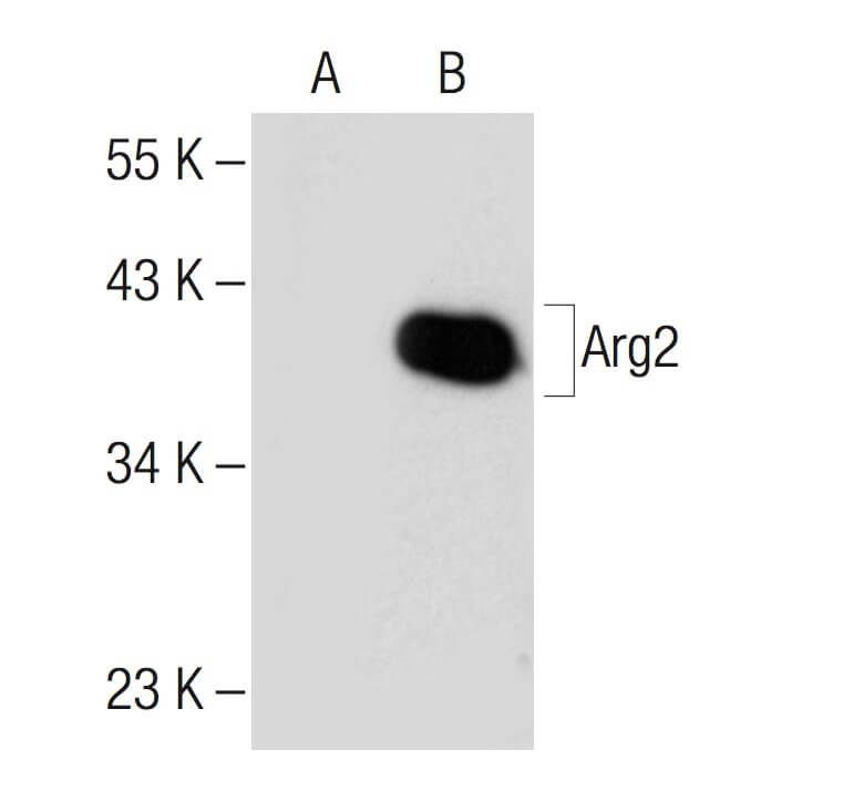 Arginase 2/ARG2 Antibody (C-3) | SCBT - Santa Cruz Biotechnology