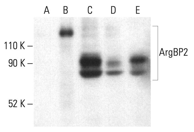 ArgBP2 Antibody (B-11) | SCBT - Santa Cruz Biotechnology