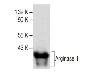 Anti-liver Arginase 1/ARG1 Antibody (A-2) | SCBT - Santa Cruz Biotechnology