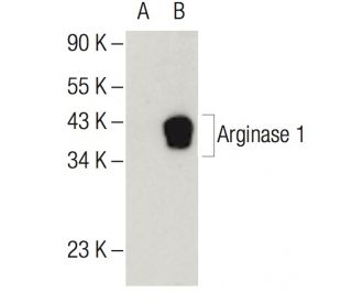 Anti-liver Arginase 1/ARG1 Antibody (C-2) | SCBT - Santa Cruz Biotechnology