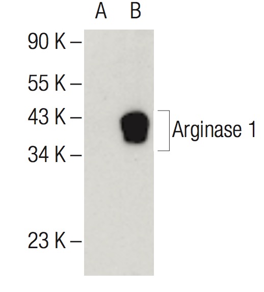 K様20:20 Arginase 1 (ARG1) Rabbit mAb