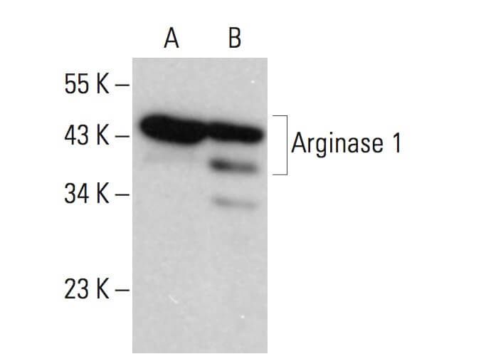 ARG1/Arginase 1 Antibody (C-2) | SCBT - Santa Cruz Biotechnology