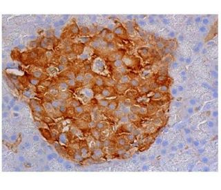 immunohistochemistry image from recommended ARG1/Arginase 1 (E-2) monoclonal antibody replacement. Image 348780