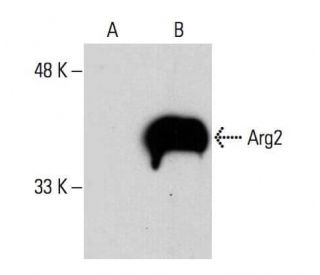 western blotting image from recommended Arginase 2/ARG2 (A-10) monoclonal antibody replacement. Image 364815
