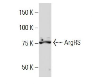 ArgRS Antibody (ZB-12) - Western Blotting - Image 34354Each CRISPR/Cas9 Knockout (KO) Plasmid product consists of a pool of 3 plasmids designed to ensure identification and cleavage of a specific gene for maximum knockout efficiency. Each plasmid encodes a unique 20 nt sequence derived from the GeCKO (v2) library.