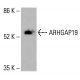 ARHGAP19 Antibody (B-5) - Western Blotting - Image 415847