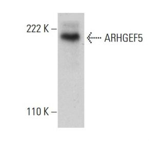 ARHGEF5 Antibody (4-YD14) - Western Blotting - Image 385124 