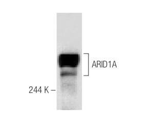 ARID1A Antibody (PSG3) | SCBT - Santa Cruz Biotechnology