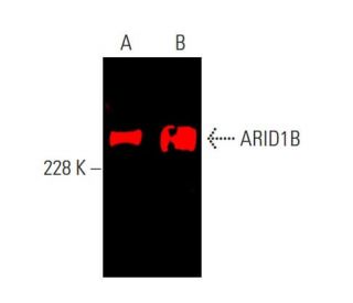 ARID1B Antibody (KMN1) - Western Blotting - Image 385411 