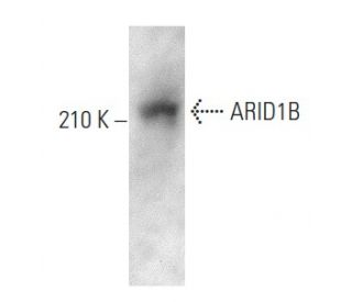 ARID1B Antibody (KMN1) - Western Blotting - Image 357281Each CRISPR/Cas9 Knockout (KO) Plasmid product consists of a pool of 3 plasmids designed to ensure identification and cleavage of a specific gene for maximum knockout efficiency. Each plasmid encodes a unique 20 nt sequence derived from the GeCKO (v2) library.