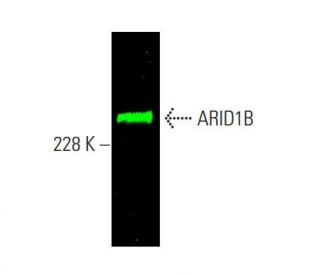 ARID1B Antibody (KMN1) - Western Blotting - Image 385410 