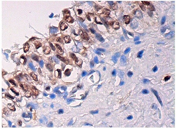 ARID2 Antibody (E-3) | SCBT - Santa Cruz Biotechnology