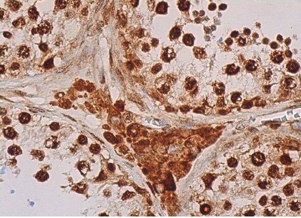 ARID2 Antibody (E-3) | SCBT - Santa Cruz Biotechnology