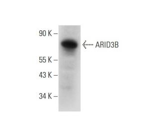 ARID3B Antibody (C-6) - Western Blotting - Image 331158SAM Transcription Activation: SAM system utilizing dCas9-VP64, MS2-P65-HSF1, and sgRNA for precise gene transcription activation.