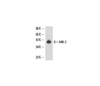 ARK-2 Antibody (13E8A7) - Western Blotting - Image 15737 