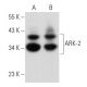 western blotting image from recommended ARK-2 (A-3) monoclonal antibody replacement. Image 356891