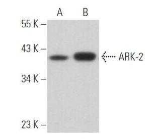 ARK-2 Antibody (13E8A7) - Western Blotting - Image 363129 