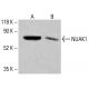 NUAK1/ARK5 Antibody (A-9) - Western Blotting - Image 414129