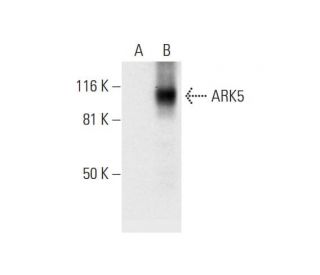 NUAK1/ARK5 Antibody (D-10) - Western Blotting - Image 295879 