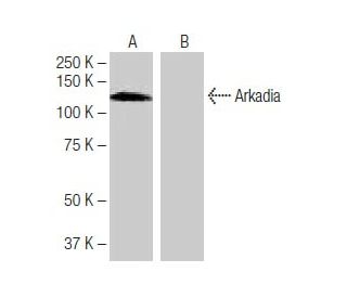 Arkadia Antibody (1-KK14) - Western Blotting - Image 64858SAM Transcription Activation: SAM system utilizing dCas9-VP64, MS2-P65-HSF1, and sgRNA for precise gene transcription activation.
