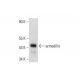 armadillo Antibody (F-6) - Western Blotting - Image 144931