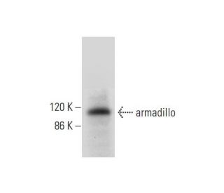 armadillo Antibody (F-6) - Western Blotting - Image 304384 