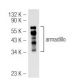 armadillo Antibody (H-7) - Western Blotting - Image 46783