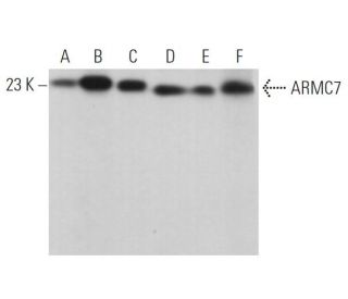 ARMC7 Antibody (G-11) - Western Blotting - Image 371054 