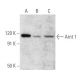 Arnt 1 Antibody (0.N.330) - Western Blotting - Image 354755