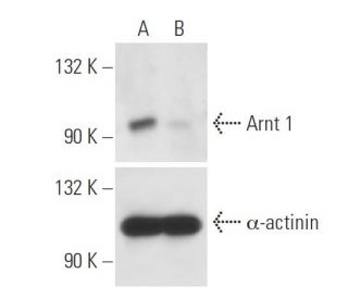 Arnt 1 siRNA (h): sc-29733. Western blot analysis of Arnt 1 expression in non-transfected control (A) and Arnt 1 siRNA tra 