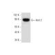 This polyclonal antibody has been discontinued. See our recommended <a href="arnt-2-antibody-b-11">Arnt 2 (B-11)</a> monoclonal antibody (sample data shown). western blotting image from recommended Arnt 2 (B-11) monoclonal antibody replacement. Image 297128
