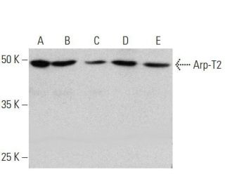 Arp-T2 Antibody (H-2) - Western Blotting - Image 352601 