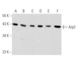western blotting image from recommended Arp2 (E-12) monoclonal antibody replacement. Image 356551
