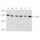 western blotting image from recommended Arp2 (E-12) monoclonal antibody replacement. Image 356551
