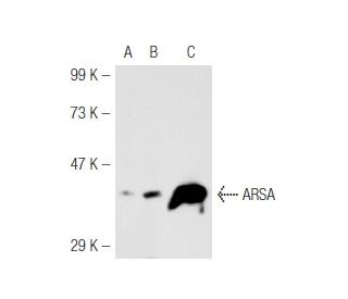 ARSA Antibody (7A) - Western Blotting - Image 45835 
