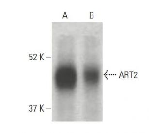 ART2 Antibody (A-2) - Western Blotting - Image 396382 