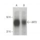 ART2 Antibody (A-2) - Western Blotting - Image 396382 