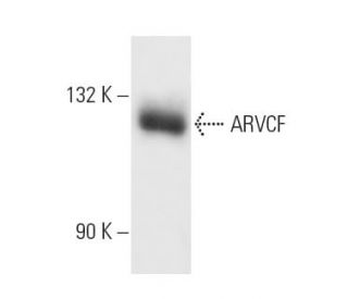 ARVCF Antibody (4B1) - Western Blotting - Image 10497 